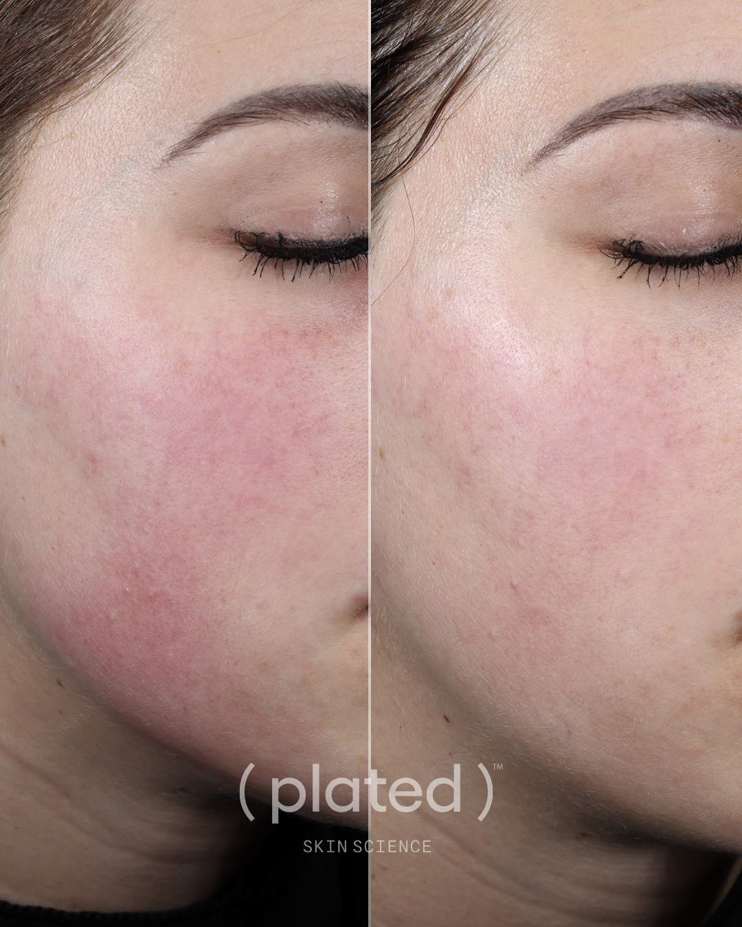 Plated Daily Serum