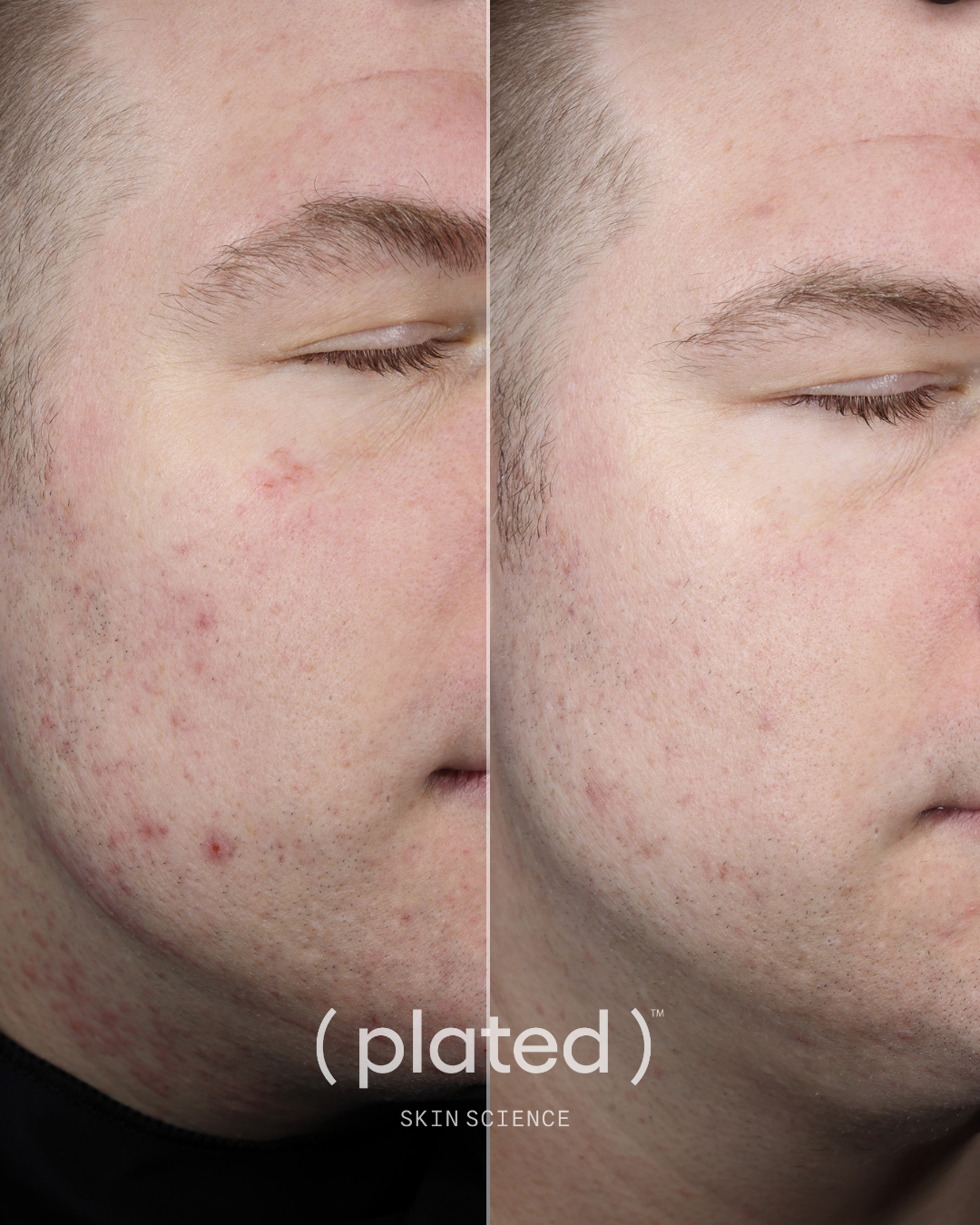 Plated Daily Serum