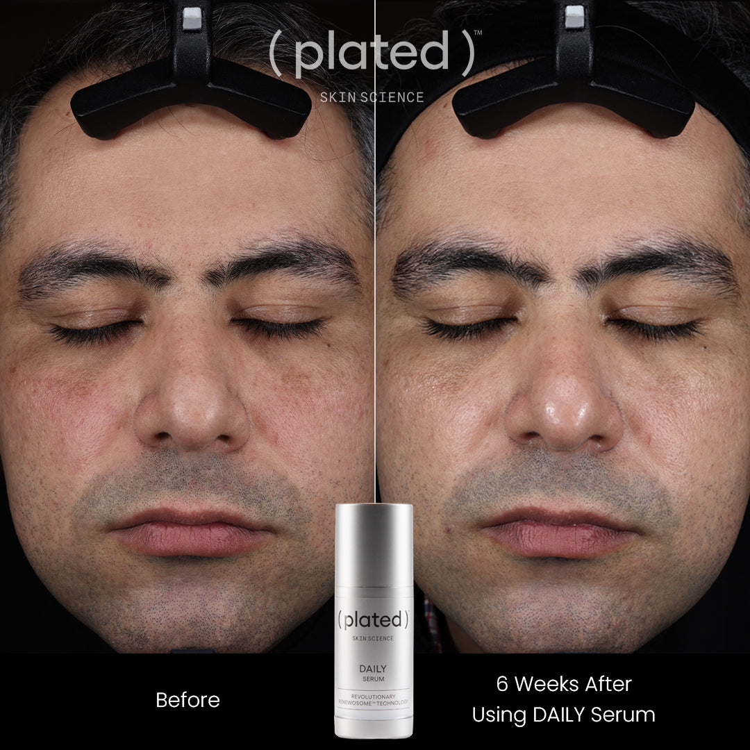 Plated Daily Serum